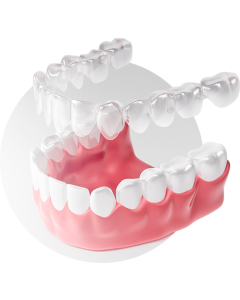 Aligners